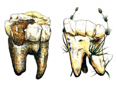 Penelitian Baru: Australopithecus Mengandalkan Makanan Tumbuhan, Sedikit Daging