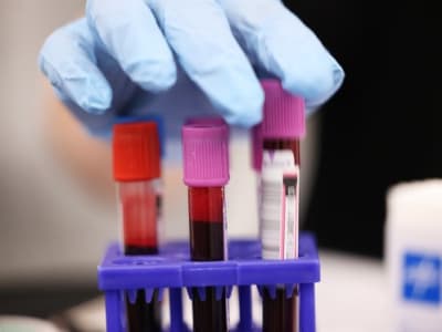 Serangan Ransomware Ganggu Suplai Darah Penting di New York Blood Center