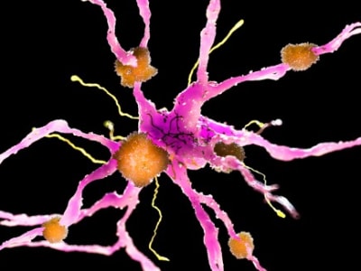 Pria Rentan Alzheimer Dini Tetap Sehat, Membuka Harapan Baru