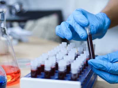 Tes Darah Baru PAC-MANN Deteksi Kanker Pankreas Lebih Awal dan Cepat