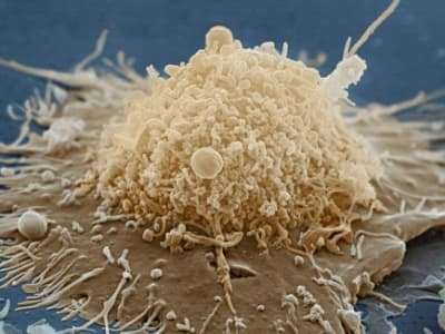 Alat AI Baru Mendiagnosis Berbagai Penyakit Lewat Urutan Gen Sel Imun