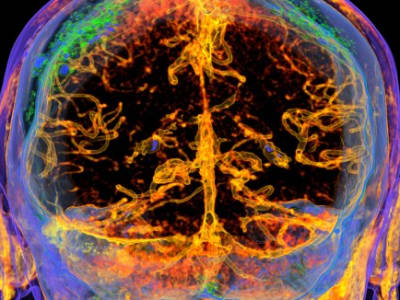 Terapi Gen untuk Memperkuat Penghalang Darah-Otak dan Memperbaiki Memori Usia Lanjut