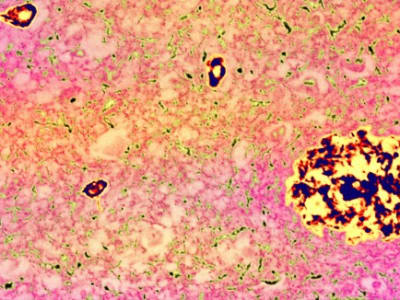 Peran Protein APP dalam Penuaan Otak Biasa dan Potensi Mengatasi Penurunan Memori