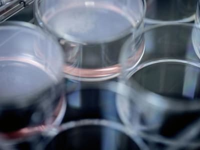 Innovent Kaji Kemitraan untuk Kembangkan Obat Kanker Inovatif IBI363