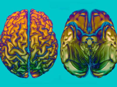 64 Gen Baru Ditemukan Memengaruhi Kecepatan Penuaan Otak Manusia