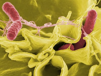 Bakteri Rekayasa Genetika Hancurkan Tumor Kanker dengan Precision Tinggi