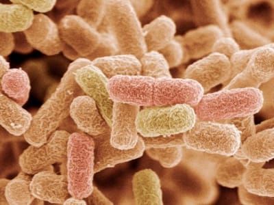 Peneliti Ciptakan Bioplastik Mirip Nilon dari Bakteri untuk Solusi Limbah Plastik