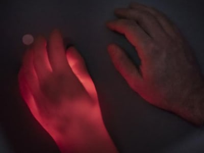 Ilusi Tangan Karet Turunkan Rasa Sakit, Terobosan Baru Pengelolaan Nyeri