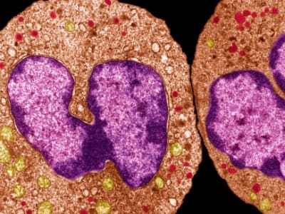 Neutrofil Perlindungi Luka dengan Membentuk Cincin Pelindung Kental