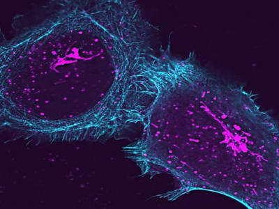 Protein Baru ArfGAP2 Buka Jalan Terapi untuk Penyakit Autoimun dan COVID-19