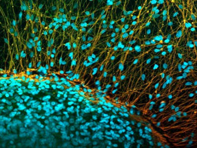 Terobosan Terapi Sel Punca Bantu Pria Lumpuh Bisa Berdiri Sendiri