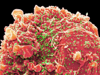 NIH dan CDC Hentikan Dana Penelitian COVID-19, Risiko Kesiapsiagaan Masa Depan