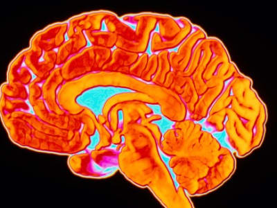 Peta Pertama Mitokondria Otak Manusia Buka Jalan Mengurai Penyakit Otak