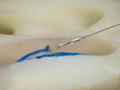 Alat Bedah Otak Mini Magnetik Bisa Mengubah Operasi Dengan Luka Minimal