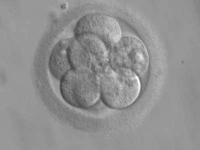 Kamera Kuantum Canggih Dukungan Baru untuk Kesuksesan Fertilisasi In Vitro