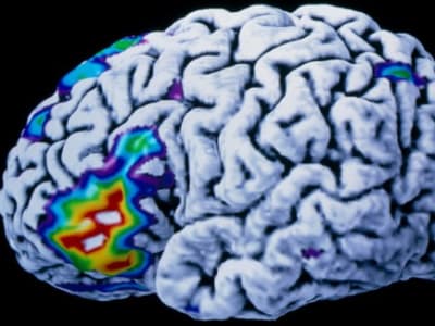 Implan Otak AI Ubah Pikiran Jadi Ucapan Real-Time Bantu Penderita Lumpuh