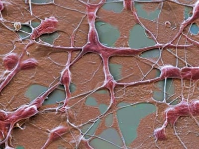 Sel Otak Pintar Bisa Hindari Sistem Imun untuk Sembuhkan Parkinson