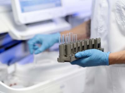 Startup Cofertility Tawarkan Pembekuan Sel Telur Gratis dengan Program Donor Unik