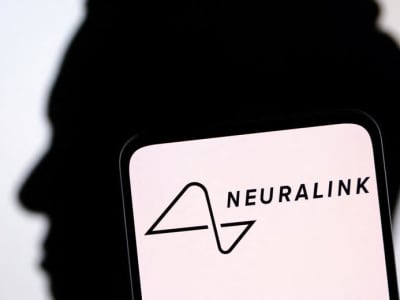 Neuralink Elon Musk Siap Kumpulkan Dana Rp 8.22 triliun ($500 Juta)  untuk Alat Otak Canggih
