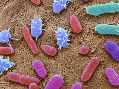 Terapi Mikroba Usus Menjanjikan Pengurangan Nyeri pada Fibromyalgia