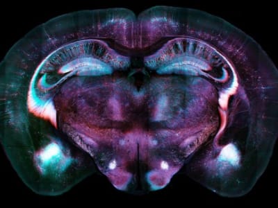 Mengenal Sinyal Otak yang Memulai Penghapusan Memori Takut pada Tikus