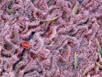 Diet Sehat Lebih Efektif daripada Transplantasi Tinja untuk Pulihkan Usus