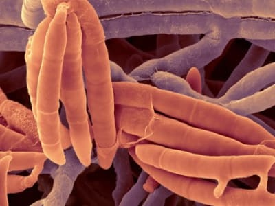 Jamur Usus Fusarium foetens Turunkan Gejala Penyakit Hati Berlemak