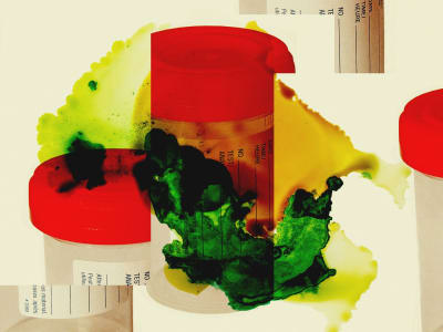 Pemutusan Kerja NIOSH Ancaman Rusaknya Ribuan Sampel Ilmiah Penting