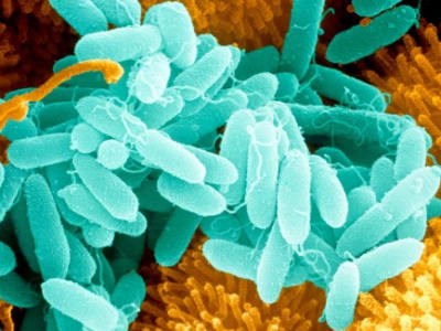 Bakteri Rumah Sakit Pseudomonas aeruginosa Punya Enzim Pengurai Plastik Berbahaya