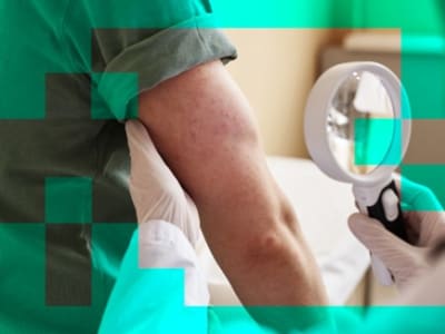 Google Perbarui Chatbot Medis, Diagnosa Ruam dan Gambar Medis Lebih Akurat