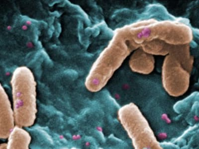 Bakteri Rumah Sakit Bisa Mengurai Plastik Medis, Ancaman Baru Infeksi