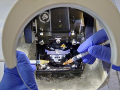 Penelitian Baru Ungkap Cara Protein Beracun Rusak Otak pada Alzheimer