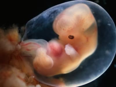 Para Ilmuwan Ciptakan Model Kantung Amniotik Terbesar dan Terbaru untuk Studi Embrio