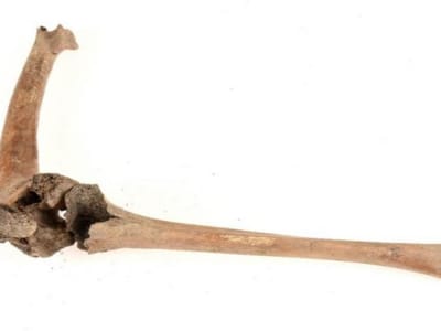 Menguak Perawatan Disabilitas Abad Pertengahan Melalui Tulang Pria Berkasta Tinggi