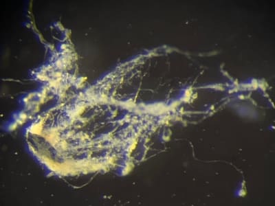 Spesies Bakteri Kabel Baru dengan Konduktivitas Listrik Tinggi dan Adaptasi Unik