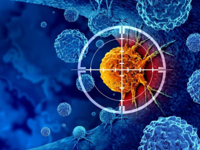 Efek Ganda Terapi Radiasi: Mengobati Kanker Namun Memicu Penyebaran Tumor