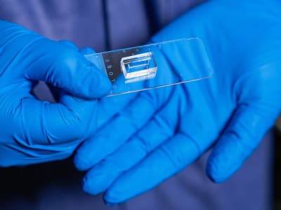 Inovasi Chip Mikrofluida untuk Meniru Pembuluh Darah Manusia dan Percepat Penelitian Penyakit Vaskular