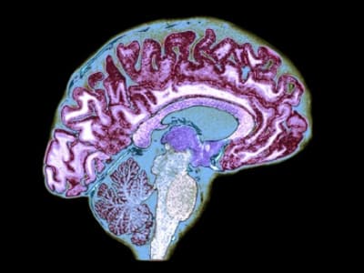 Sel T Khusus di Otak Kendalikan Perilaku Makan Melalui Sistem Imun
