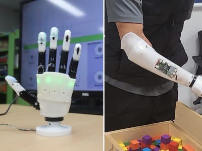 Tangan Prostetik Robotik Ringan dengan Kontrol Presisi dan Adaptasi Bentuk