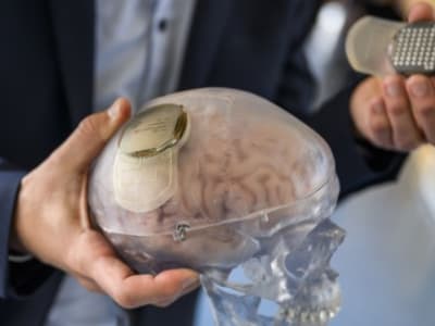 UNESCO Tetapkan Prinsip Etika untuk Lindungi Hak Pengguna Neuroteknologi