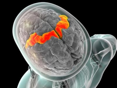 Alat Otak-Komputer Mengubah Sinyal Otak Jadi Suara Alamiah Real-Time