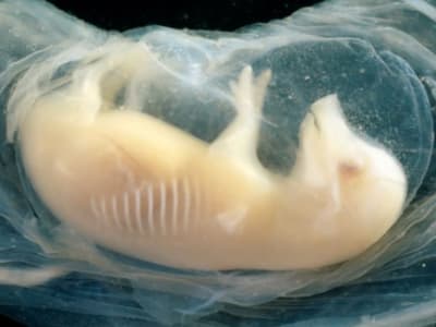 Ilmuwan Kembangkan Jantung Manusia dalam Embrio Babi yang Berdenyut