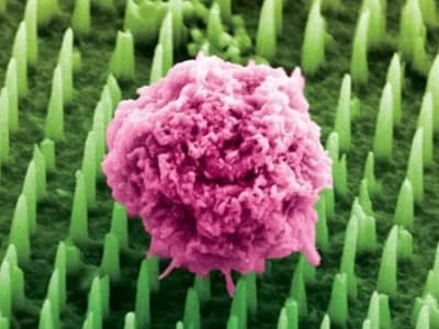 Patch Nanonadels Revolusioner Menghilangkan Nyeri Biopsi dan Mempercepat Diagnosa