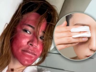 Bahaya Memakai Make-up 22 Tahun Tanpa Membersihkan, Wajah Terluka Parah