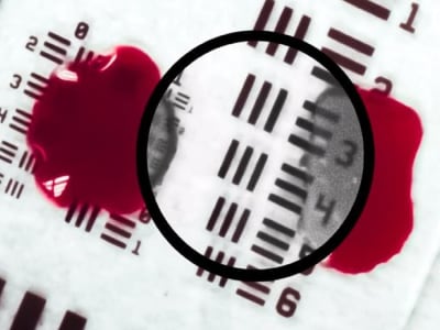 Teknologi Baru AI Membantu Dokter Melihat Melalui Darah Saat Operasi