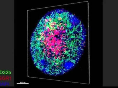 Terobosan Organ Hati Buatan yang Bisa Membentuk Pembuluh Darah Sendiri