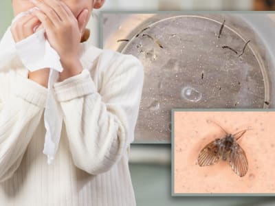 Gadis 8 Tahun di China Muntah Larva Lalat Saluran Pembuangan, Kasus Medis Langka