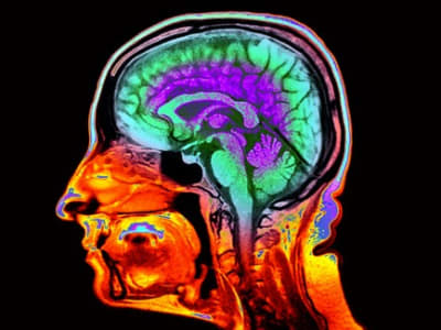 Mempercepat Deteksi Penuaan Otak dengan Citra MRI untuk Prediksi Risiko Kognitif