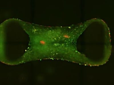 Organoid Jantung Miniatur Percepat Pengobatan Penyakit Jantung Anak