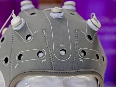 China Dukung Inovasi Alat Medis Otak-Komputer Bantu Kendalikan Anggota Tubuh